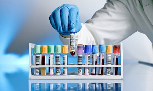Medical Tests and Signs image