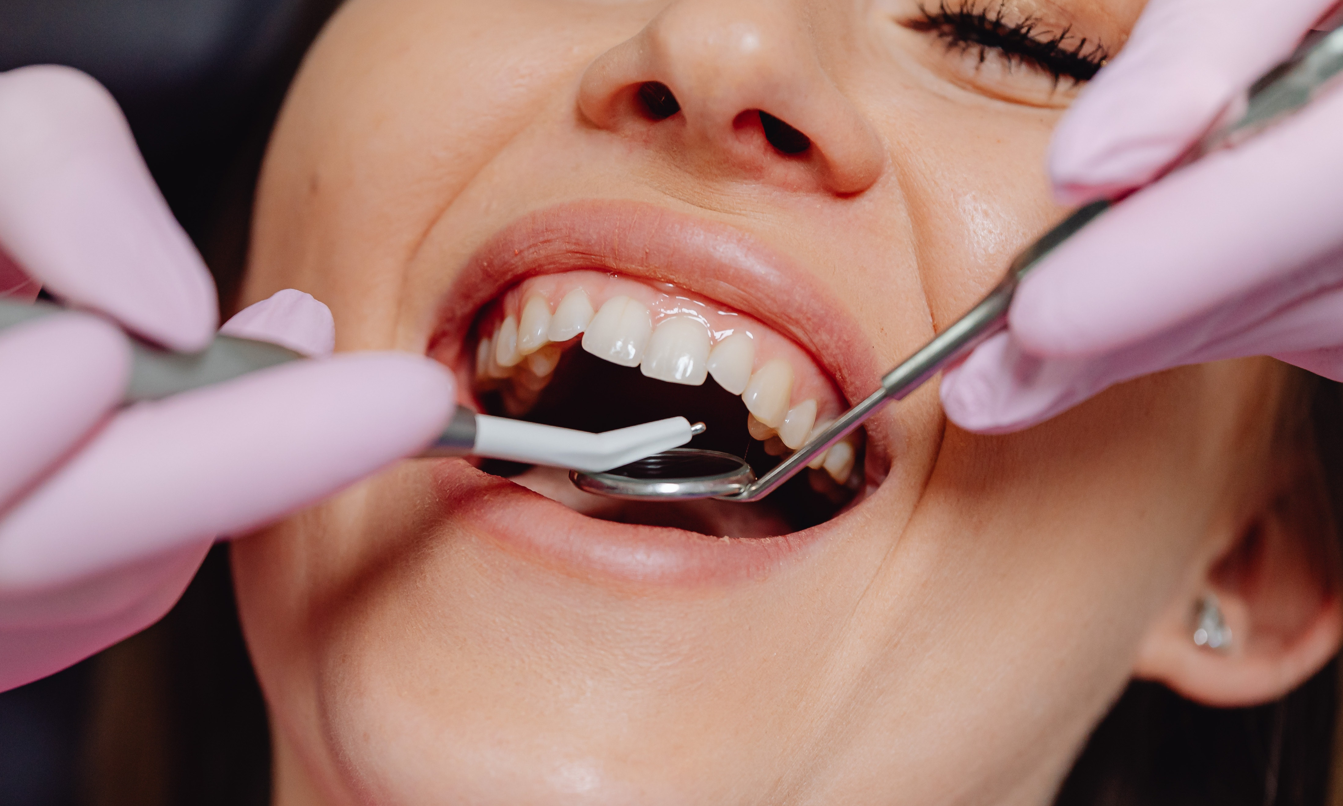 Dental Benefits Associate (DBA) Designation image